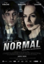 Normal